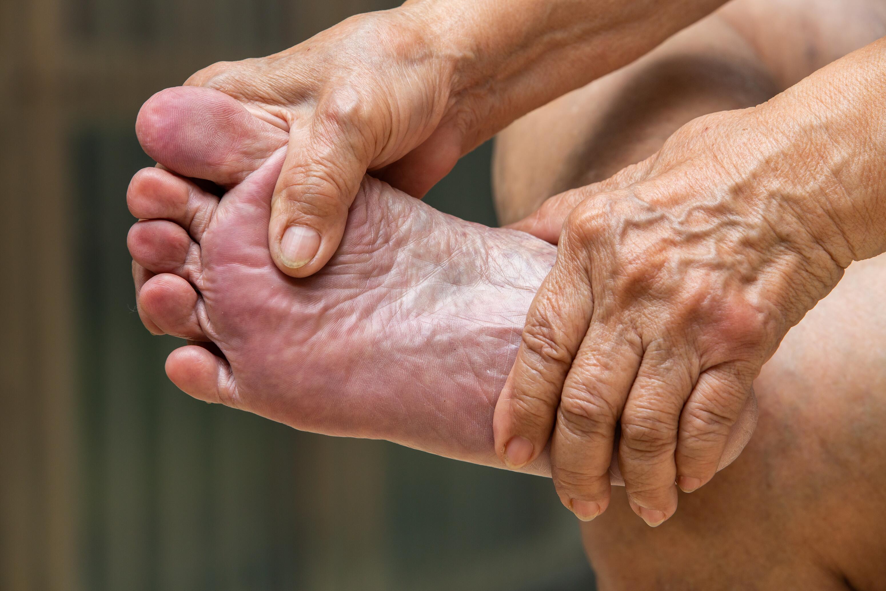 
            md_dexeryl_website-diabetic-foot-image_adobestock_212753662
        